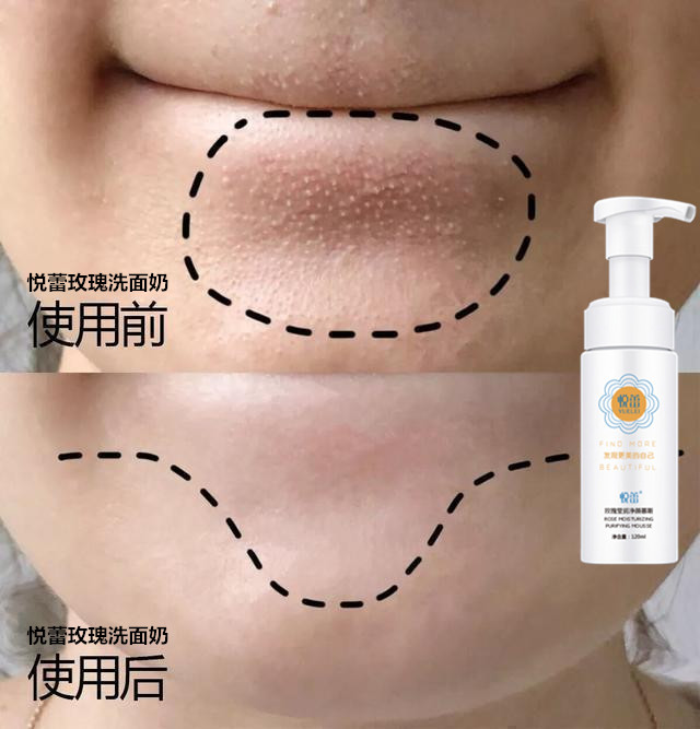 4610b912c8fcc3ce25d5dfc65d662481d53f20df_副本.jpg 4610b912c8fcc3ce25d5dfc65d662481d53f20df_副本.jpg